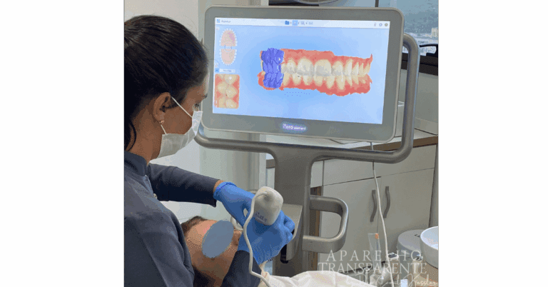escaneamento intra oral aparelho transparente