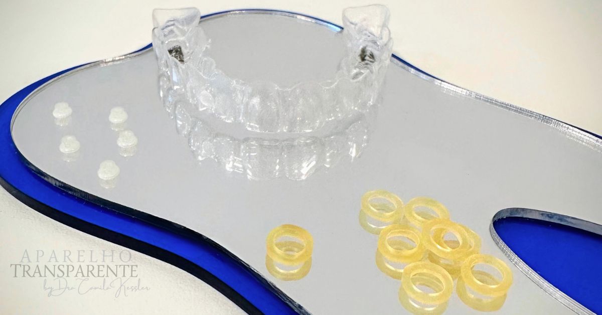 elastico botao alinhador transparente