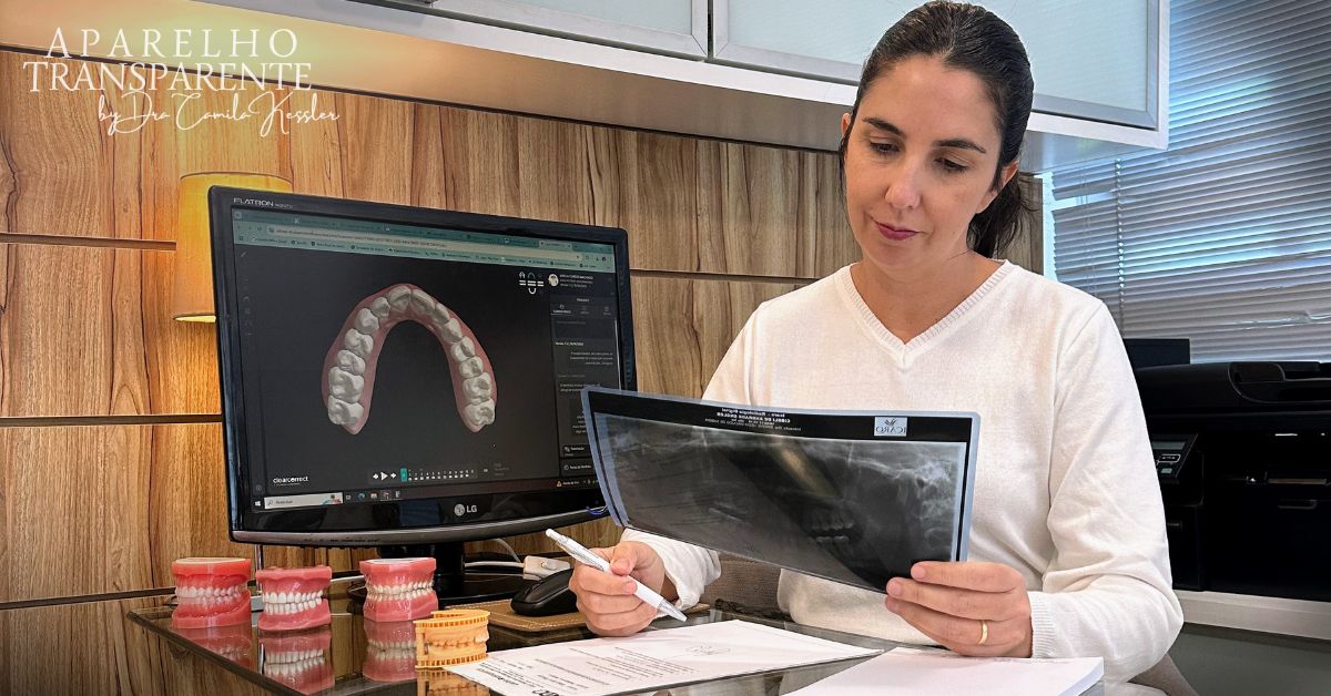 Consulta de acompanhamento ortodôntico — revisão do planejamento digital 3D com alinhadores transparentes, Dra. Camila Kessler, Florianópolis